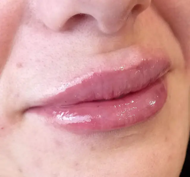 კოსმეტოლოგია — SANLE Beauty Salon, თბილისი